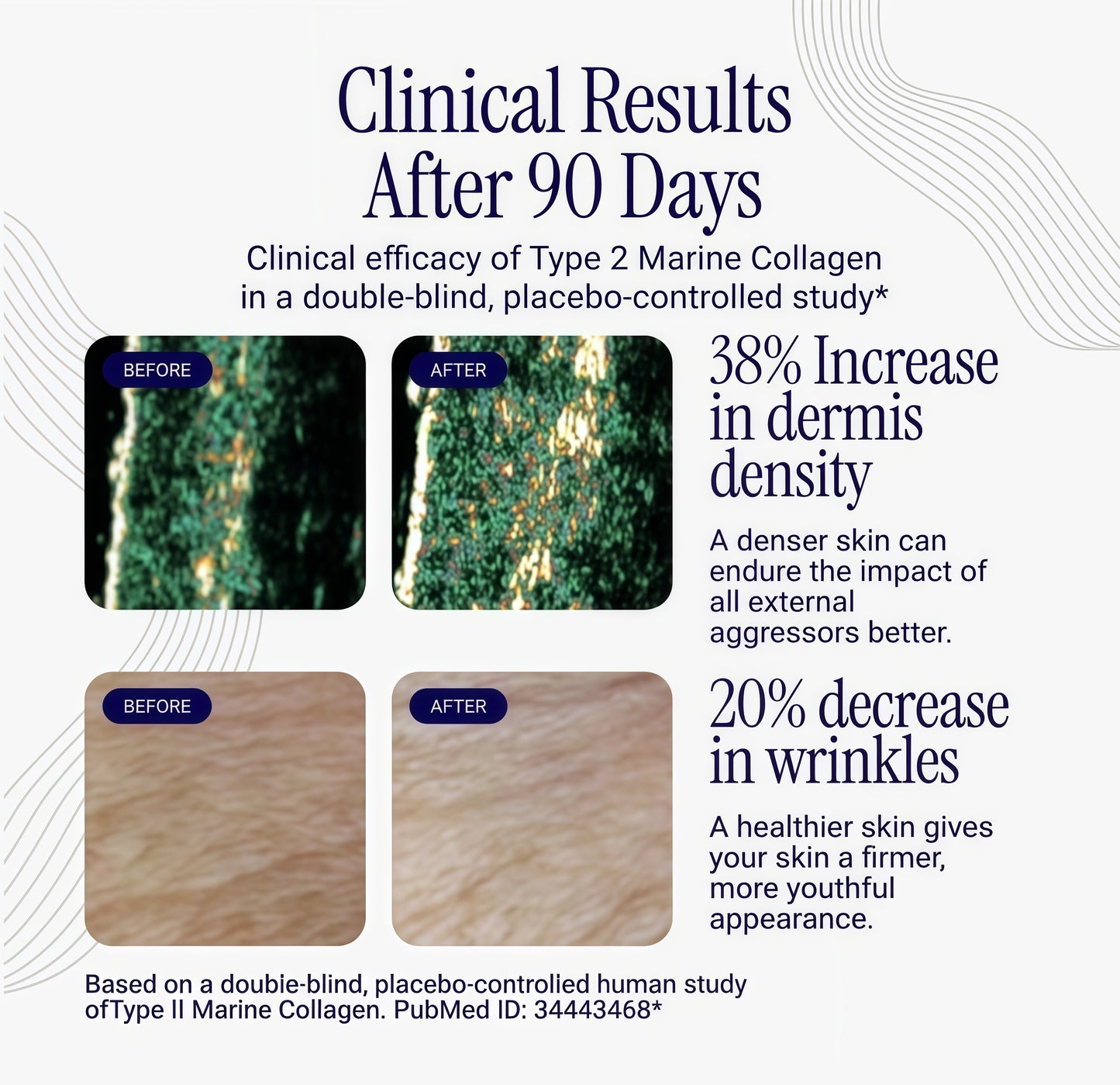 Rho Nutrition Liposomal collagenPeptides -High-Absorption LiquidCollagen Supplement -supports SkinElasticity, Joint Health, and OverallVitality for Healthy Aging, 5 fl oz